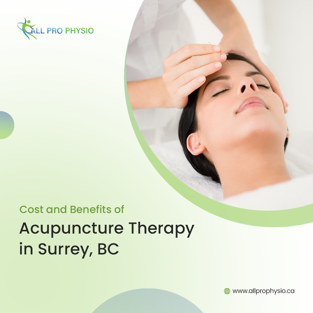 Cost And Benefits of Acupuncture Therapy In Surrey, BC