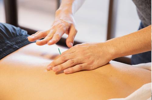Acupuncture Therapy service